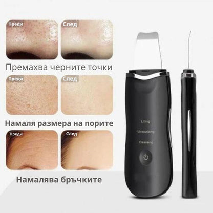 Ултразвукова шпатула за почистване на лице muye 8815 ефект след използване